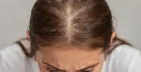 Foto: (Imagem sem texto alternativo disponivel ID [2712190])