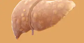 Foto: (iStock/luismmolina)