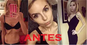 Vítima de anorexia, britânica exibe recuperação no Instagram