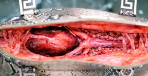 Foto: (Imagem sem texto alternativo disponivel ID [1080185])