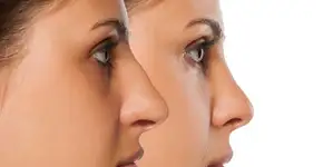 Selfies motivam 55% das plásticas faciais, aponta pesquisa