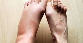 Foto: (vidka/istock)