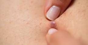 Foto: (Ocskaymark/istock)