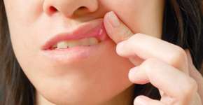 Foto: (Imagem sem texto alternativo disponivel ID [1562140])