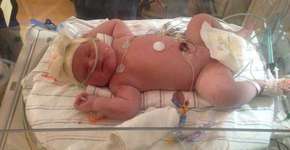 Bebê de mulher considerada infértil nasce com 6,8 kg