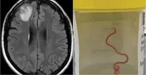 Foto: (divulgação/cdc.gov)