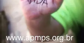 Pacientes com doenças raras fazem mobilização para pressionar STF