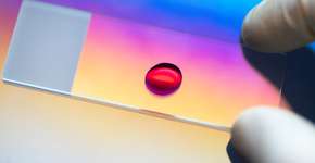 Foto: (jxfzsy/istock)