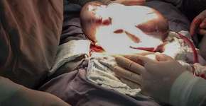 Bebê nasce empelicado no litoral de São Paulo