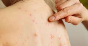 Foto: (Mixmike/istock)