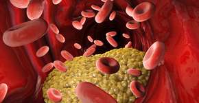 Foto: (Naeblys/istock)