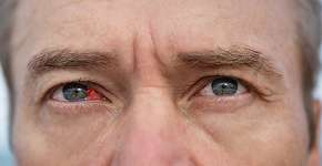 Foto: (iStock/Oleksandra Iablochnikova)