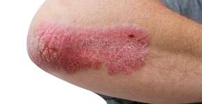 Foto: (JodiJacobson/istock)