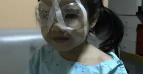 Menina de 4 anos faz cirurgia nos olhos após uso excessivo de celular