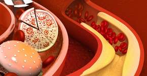 Estes alimentos populares vão ajudar a reduzir o colesterol LDL