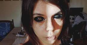 Jovem fica quase cega após tatuar globo ocular; tatuador pode ir preso