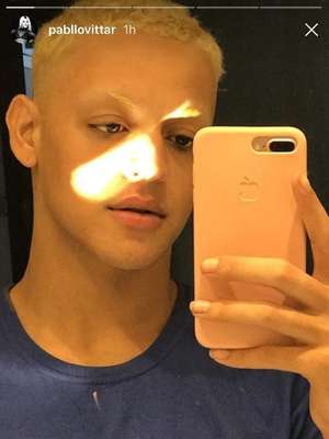 Com o siso inflamado, Pablo Vittar aparece sem produção no Insta Stories 