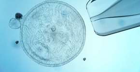 Foto: (Getty Images)