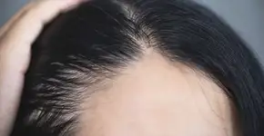 Estudo descobre que remédio para artrite faz cabelo crescer