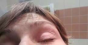 Foto: (divulgação/NEJM)