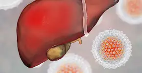 O que quer dizer gordura no fígado grau 3 e quais os sintomas