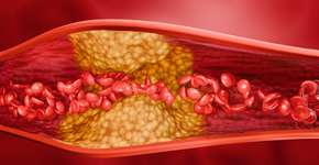 Foto: (iSTock/Chinnachart Martmoh)