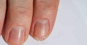 Foto: (FotoPrivet/DepositPhotos)