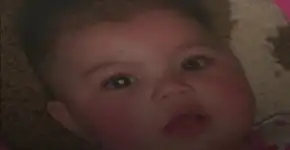 Com apenas uma foto foi possível identificar um câncer