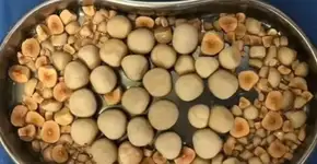 Foto: (Reprodução/Zhongda Hospital)