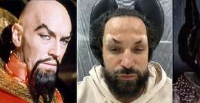 Latino faz rejuvenescimento facial e vira meme