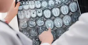 Bebida simples e diária que pode ajudar na prevenção de demência