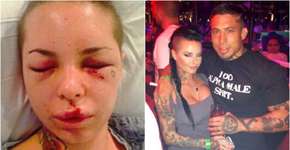 Atriz espancada pelo ex-namorado decide não vê-lo no tribunal