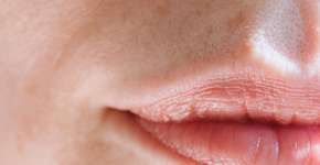 Cientistas conseguem rejuvenescer a pele de mulher em 30 anos