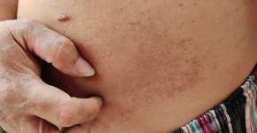 Foto: (Rungrudee/itock)