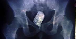 Foto: (Imagem sem texto alternativo disponivel ID [1053104])