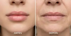 Foto: (Imagem sem texto alternativo disponivel ID [2775627])