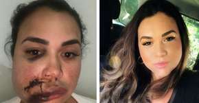 Mulher relata agressão dentro de restaurante de luxo no Jockey Club