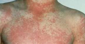 Foto: (divulgação/NHK)