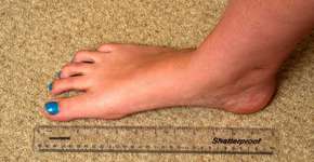 Foto: (Imagem sem texto alternativo disponivel ID [928914])