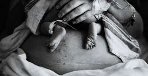 Mulher processa hospital após passar por cesariana sem anestesia