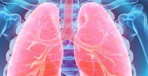 Câncer de pulmão em não fumantes