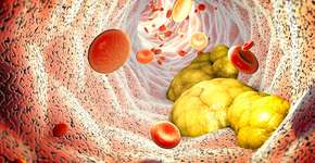 Foto: (iSTock/Naeblys)