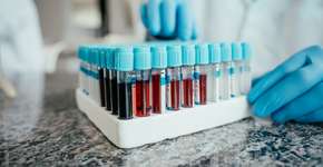 Foto: (Drs Producoes/istock)