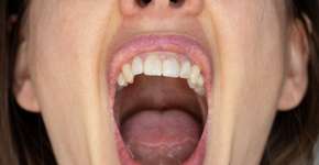 Foto: (Depositphotos/vikabest88@gmail.com)