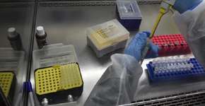 Pesquisadores brasileiros inventam forma de detecção da hepatite D