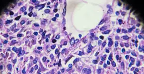 Foto: (jxfzsy/istock)