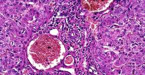 Foto: (tonaquatic/istock)