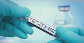 Foto: (narvikk/istock)