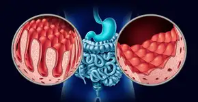 Foto: (lightsource/DepositPhotos)