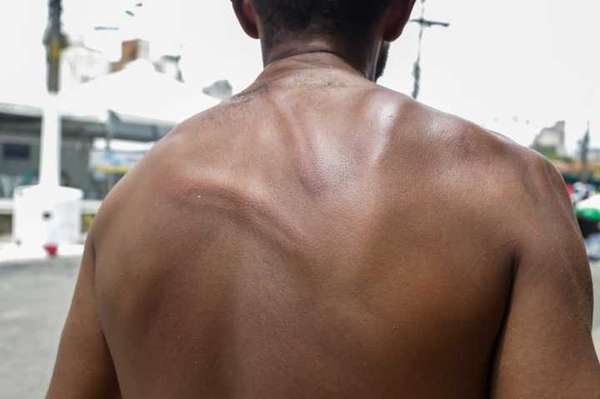 As agressões aos moradores da cracolândia são frequentes